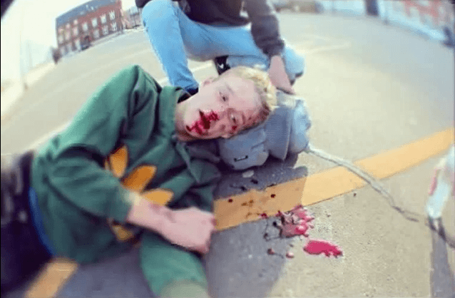 Kid knocks his teeth out on a 3 stair rail